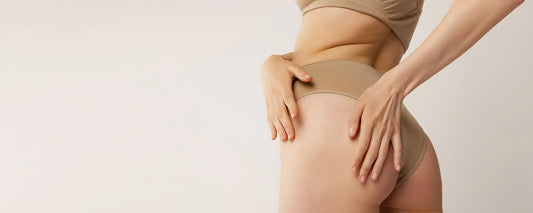 Lipödem oder Cellulite: Die wichtigsten Unterschiede auf einen Blick