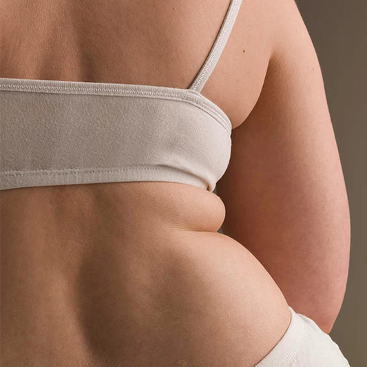 Cellulite Schweregrad